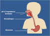 24-hour pH and Impedance Monitoring (Outpatient) - A guide for parents ...