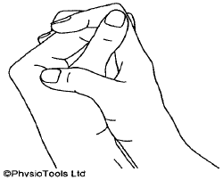 Soft Tissue Injury: Finger | Hull University Teaching Hospitals NHS Trust