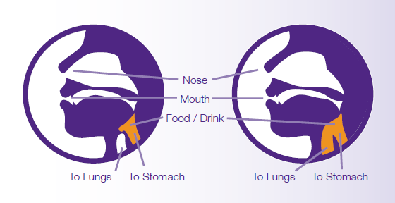 Eating and Drinking for Quality of Life | Hull University Teaching ...