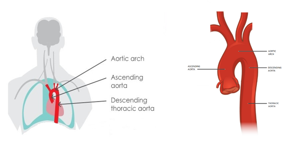 Diagram of aorta